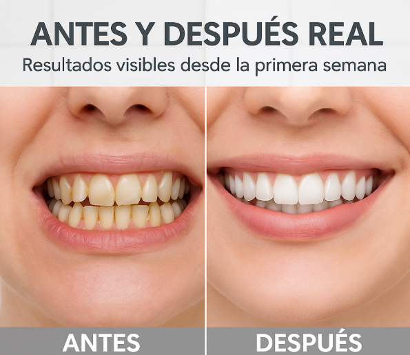 Jet Dental 360°: Dientes limpios y aliento perfecto!