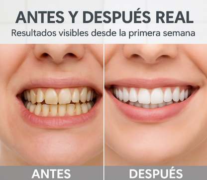 Jet Dental 360°: Dientes limpios y aliento perfecto!